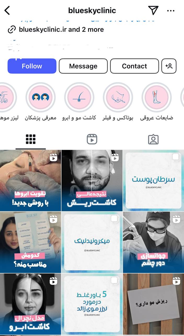 کاشت مو کرج