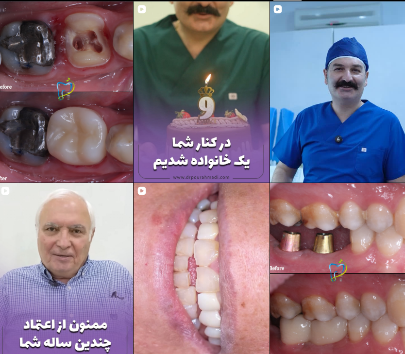 لیست دکتر کامپوزیت در کرج