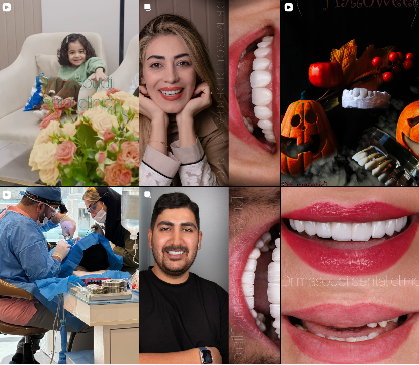 برترین کامپوزیت در کرج