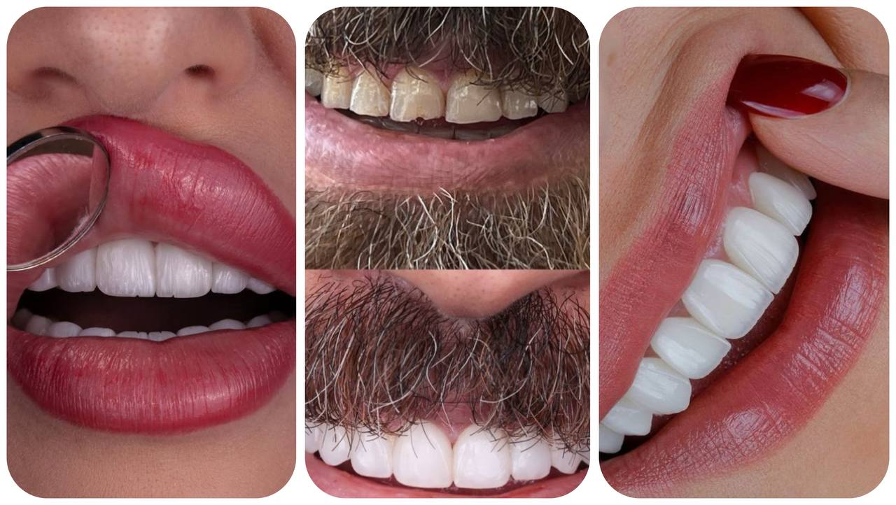 کامپوزیت دندان کرج