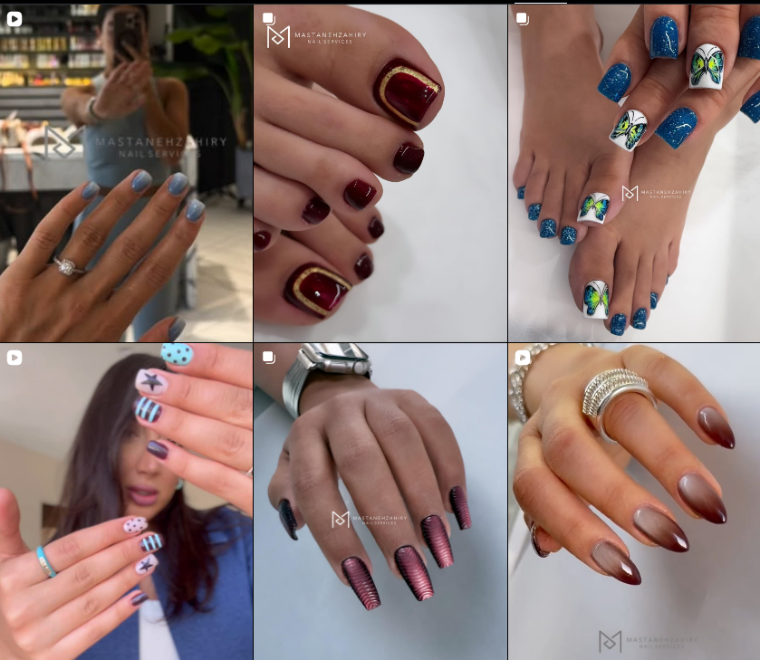 کاشت ناخن کرج