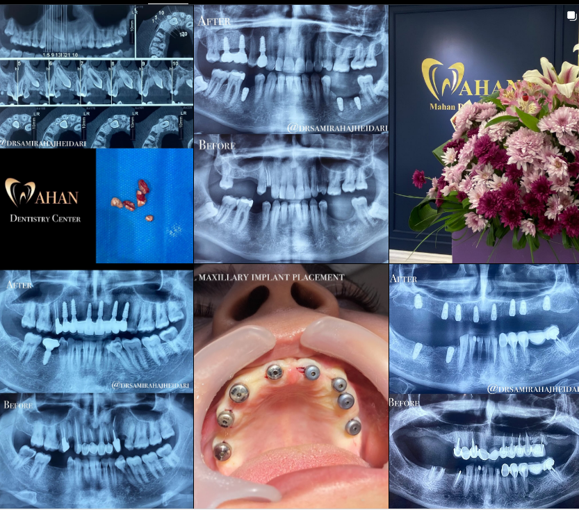 برترین دندانپزشک در کرج