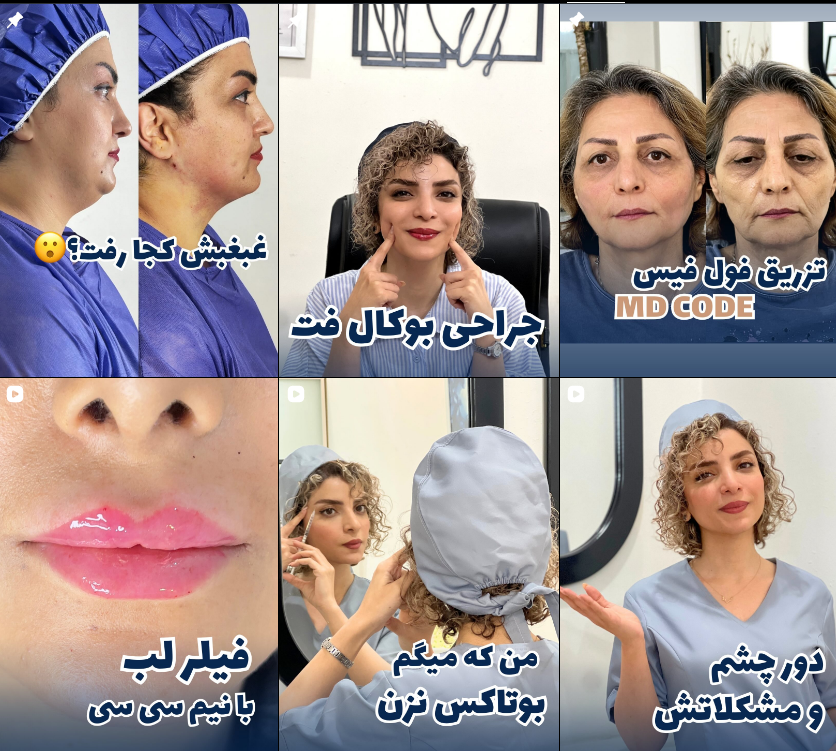 معرفی دکتر تزریق ژل و فیلر در کرج