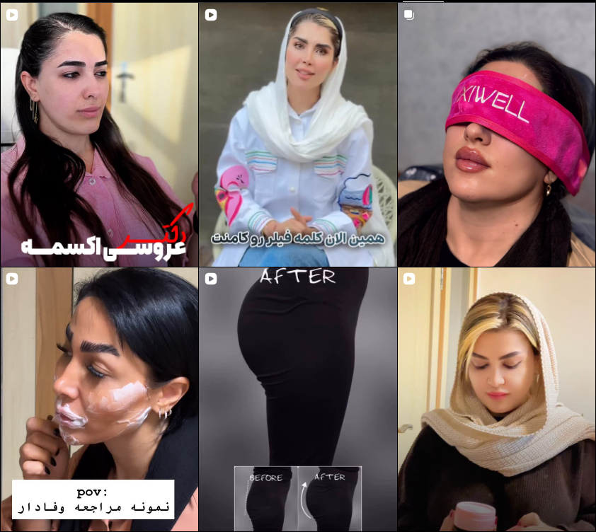 برترین دکتر تزریق ژل و فیلر در کرج