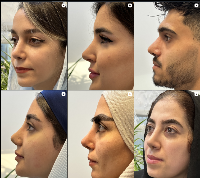 بهترین جراح بینی کرج