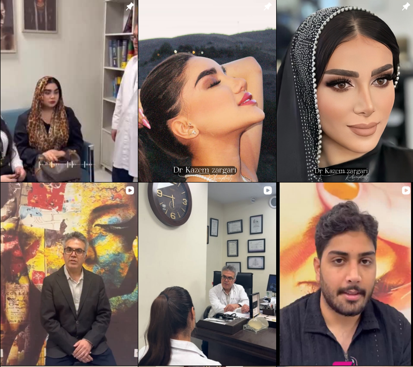 بهترین رینوپلاستی در کرج