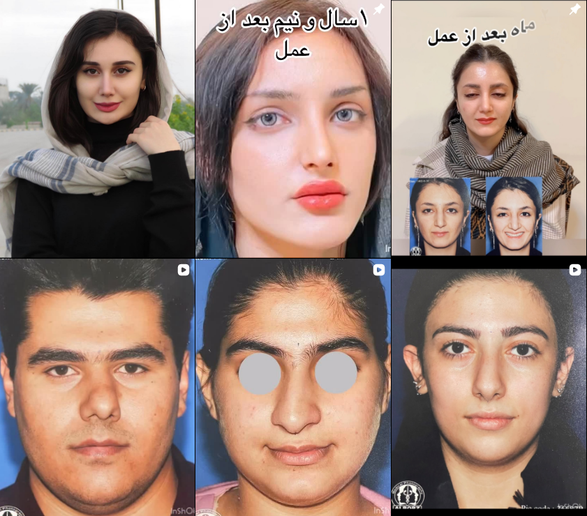 معرفی پزشک رینوپلاستی در کرج