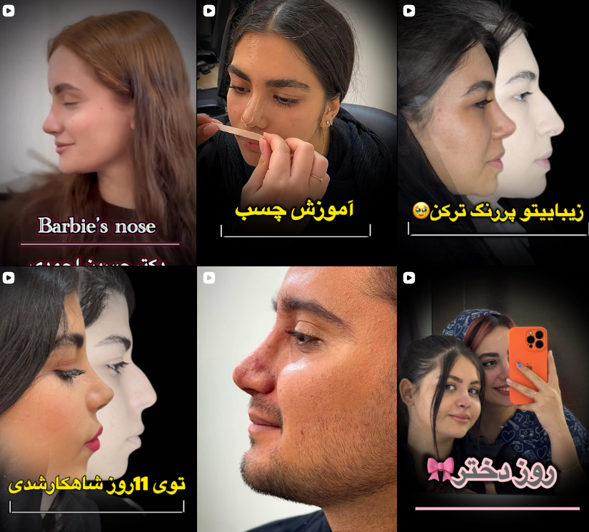 بهترین جراح بینی در کرج