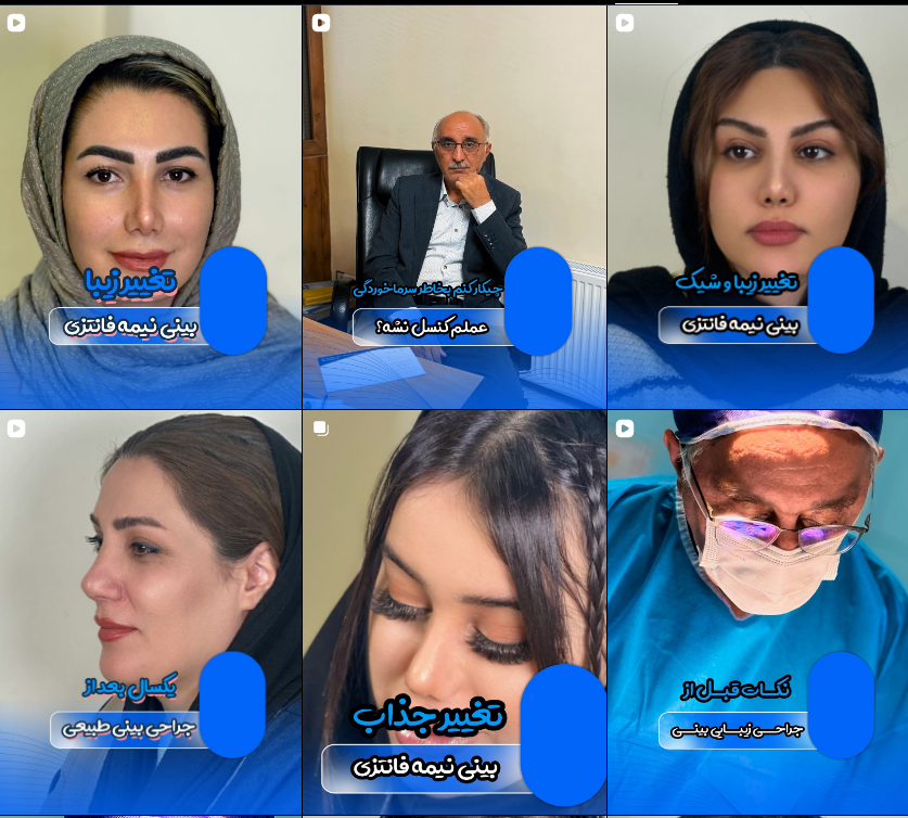 معرفی جراح بینی در کرج