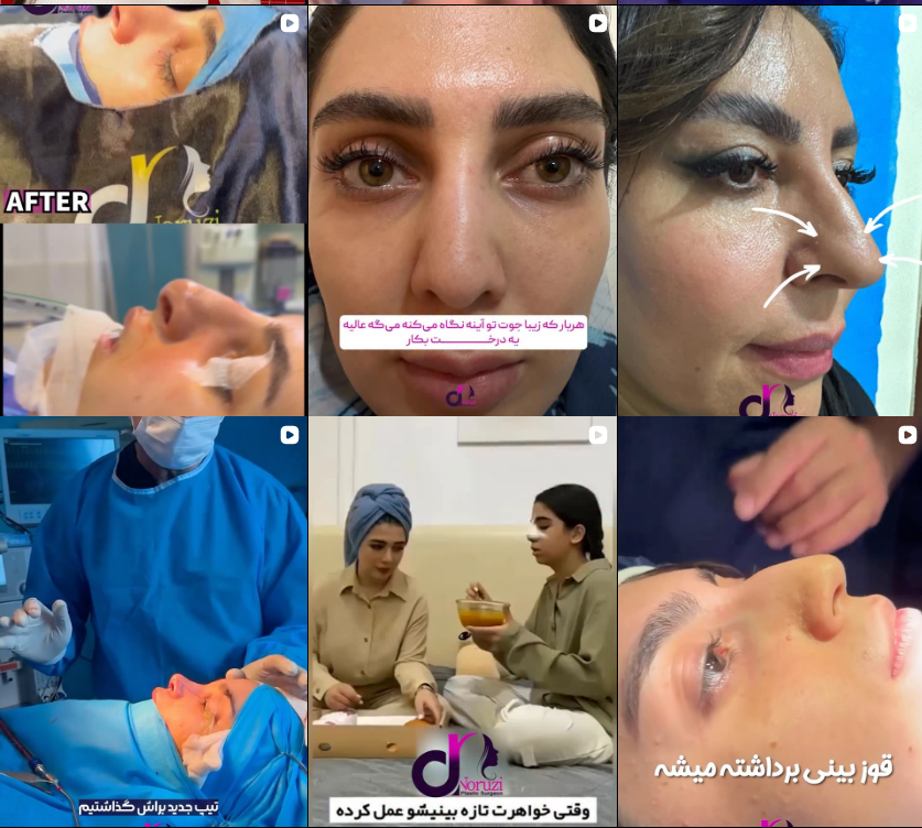 لیست جراح بینی در کرج