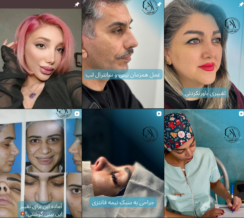 برترین جراح بینی در کرج