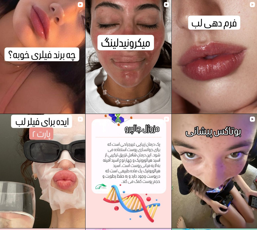 معرفی بهترین کلینیک کاشت مو در کرج