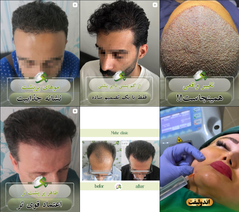 لیست کلینیک کاشت مو در کرج