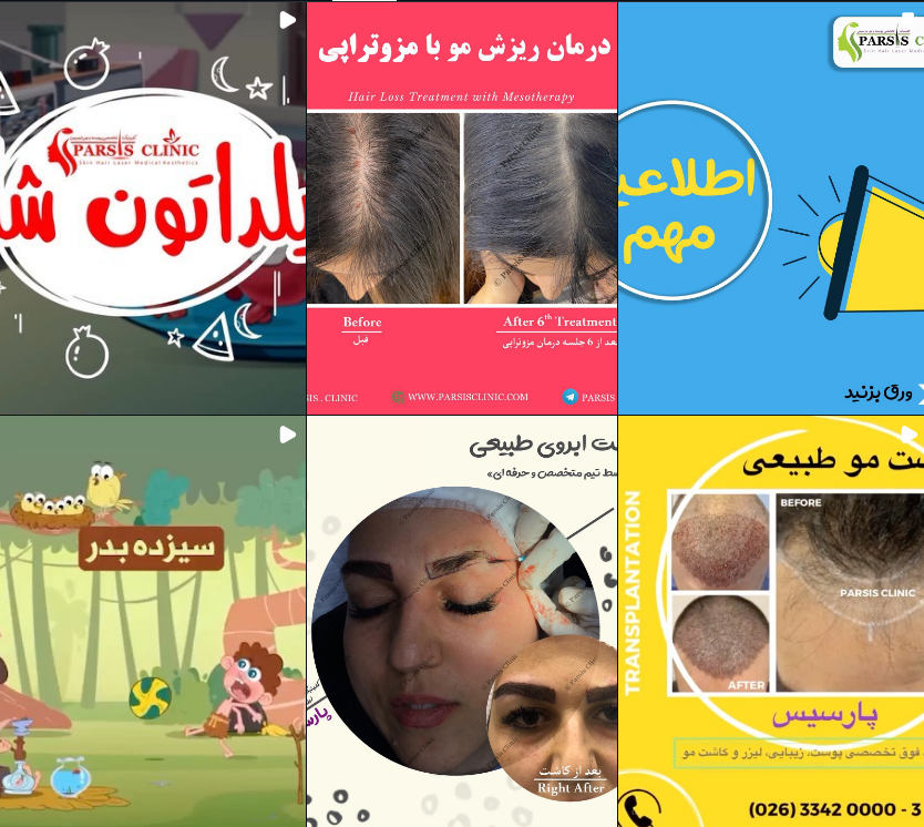 لیست کلینیک کاشت مو در کرج