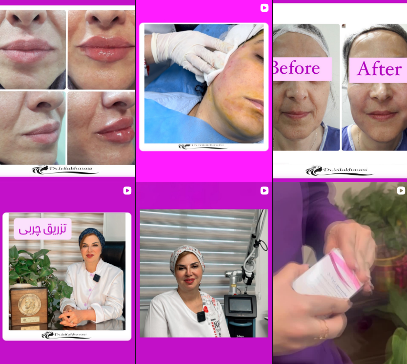 کلینیک کاشت مو در کرج