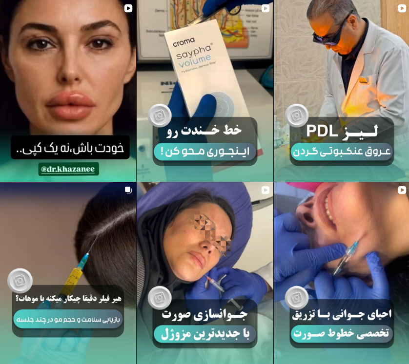 معرفی کلینیک کاشت مو در کرج