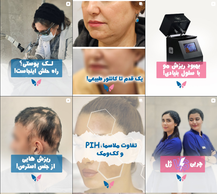 برتریین کلینیک کاشت مو در کرج