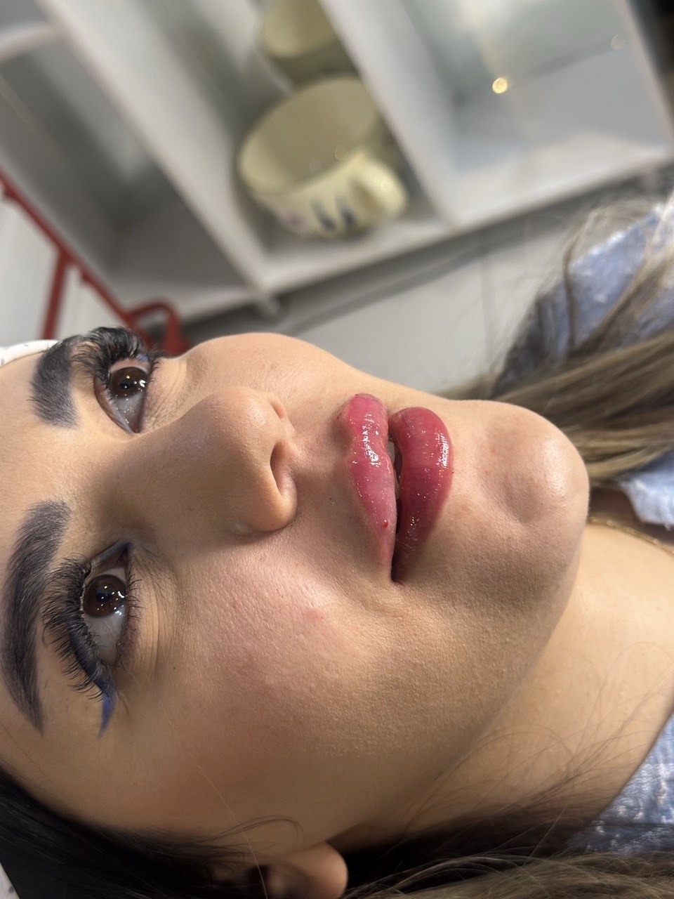 دکتر تزریق ژل و فیلر در کرج