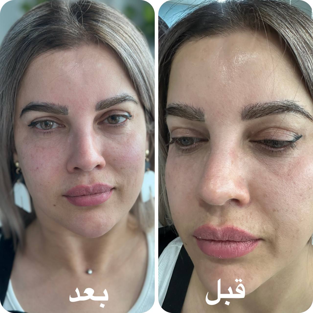 بهترین خدمات زیبایی در کرج