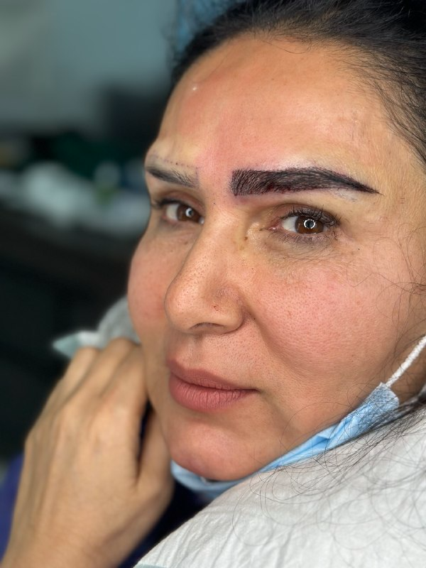 کاشت ابرو در کرج