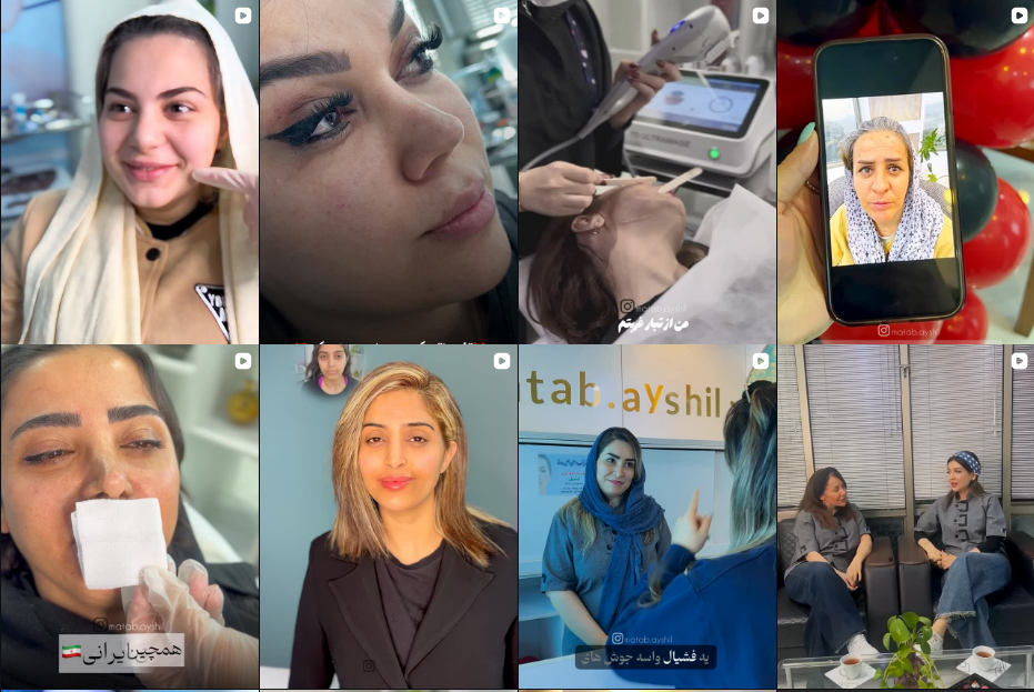 برترین دکتر تزریق ژل و فیلر در کرج