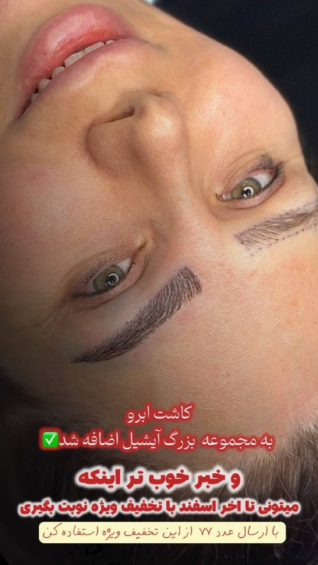 دکتر تزریق ژل و فیلر کرج