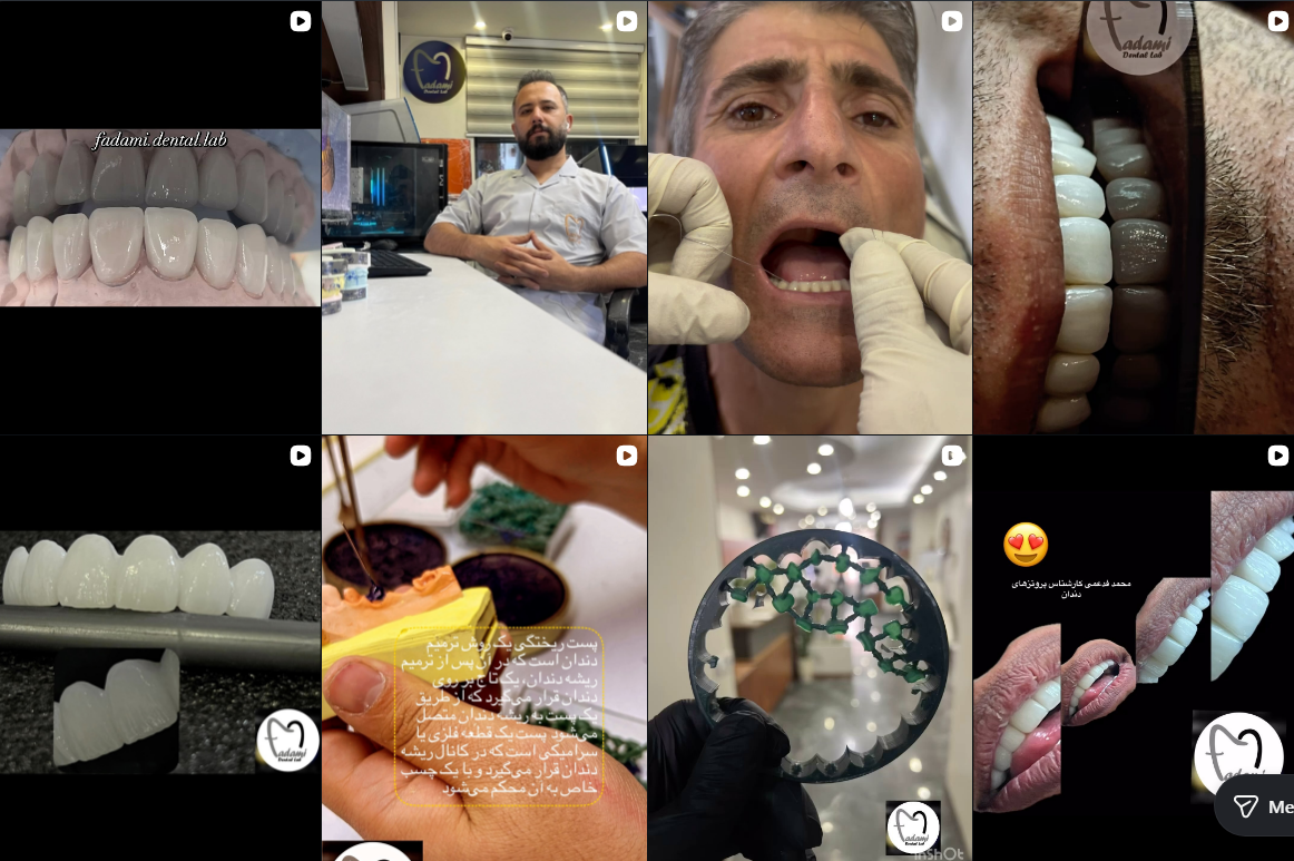 بهترین دندانسازی در کرج