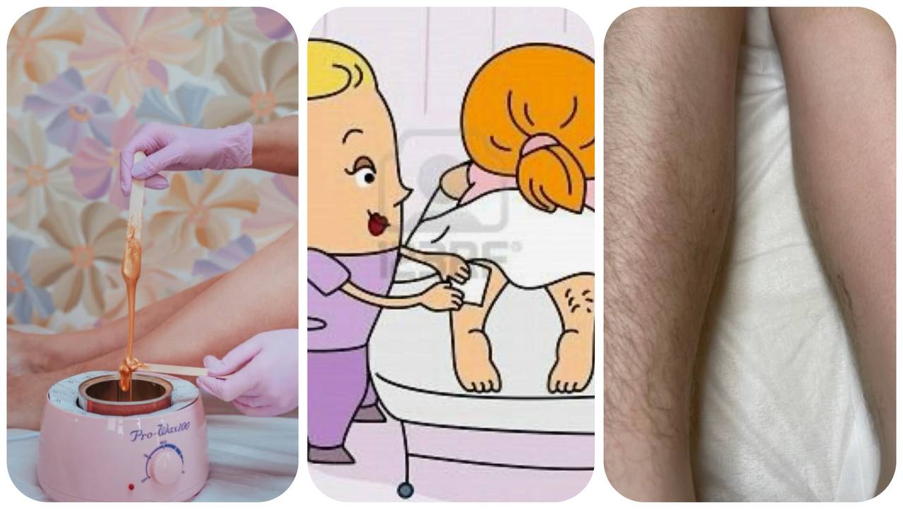 اپیلاسیون در کرج