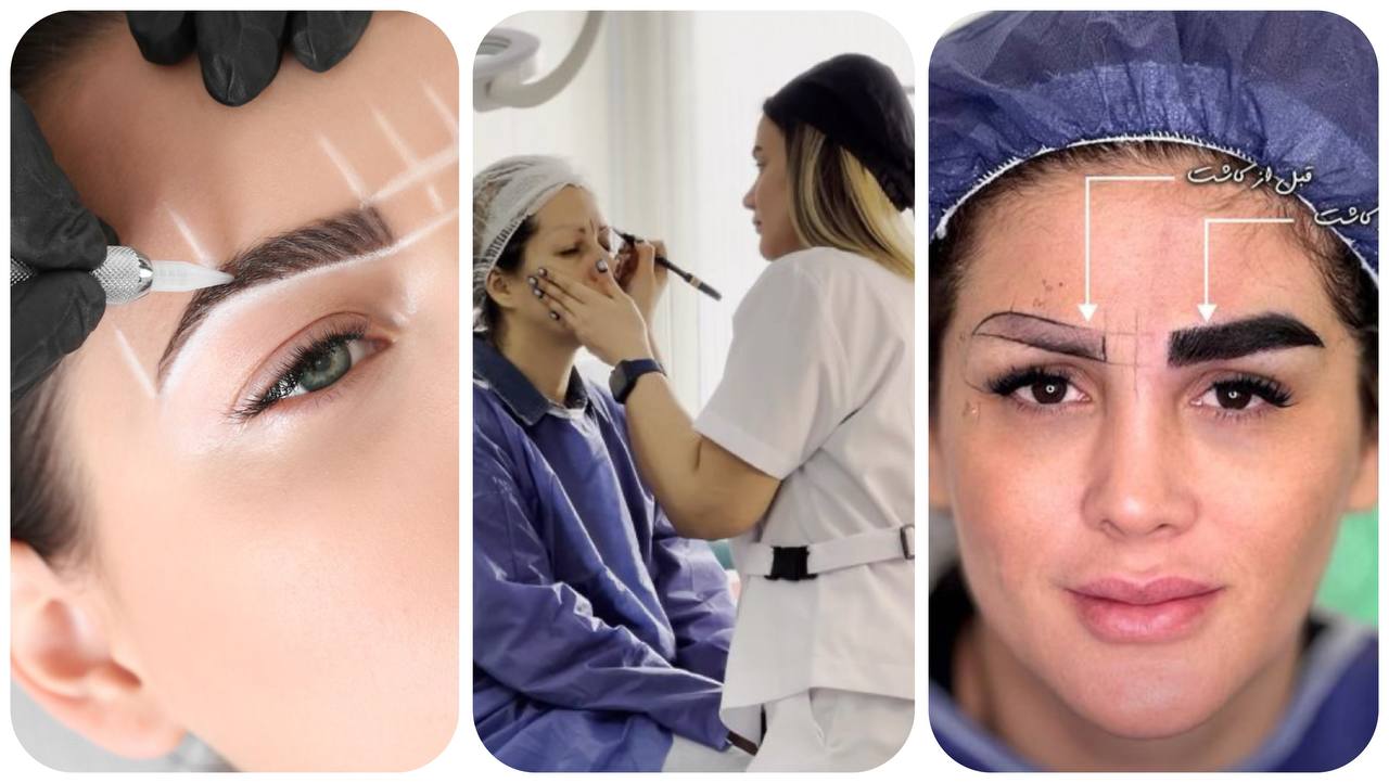 خدمات کاشت ابرو در کرج