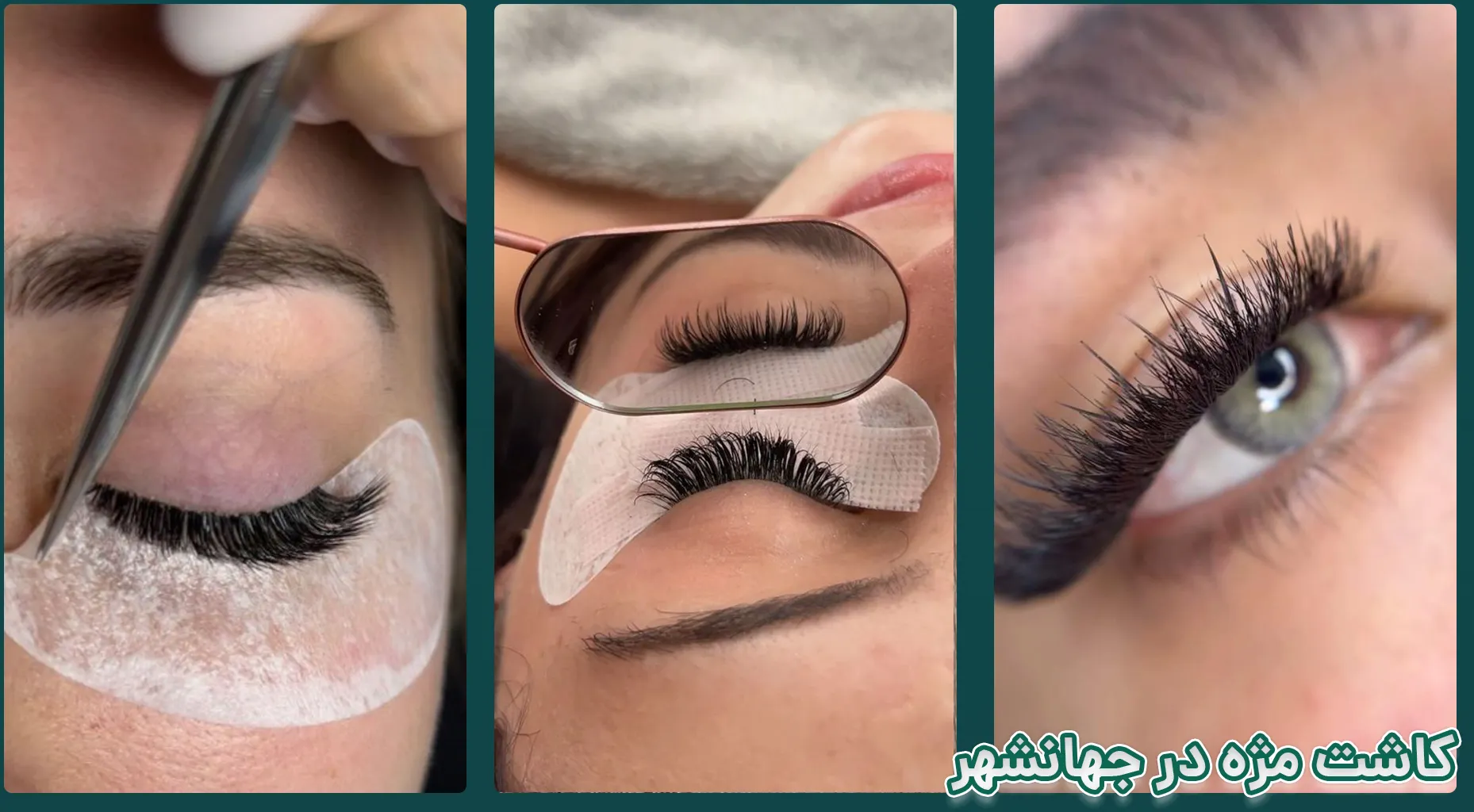 کاشت مژه جهانشهر