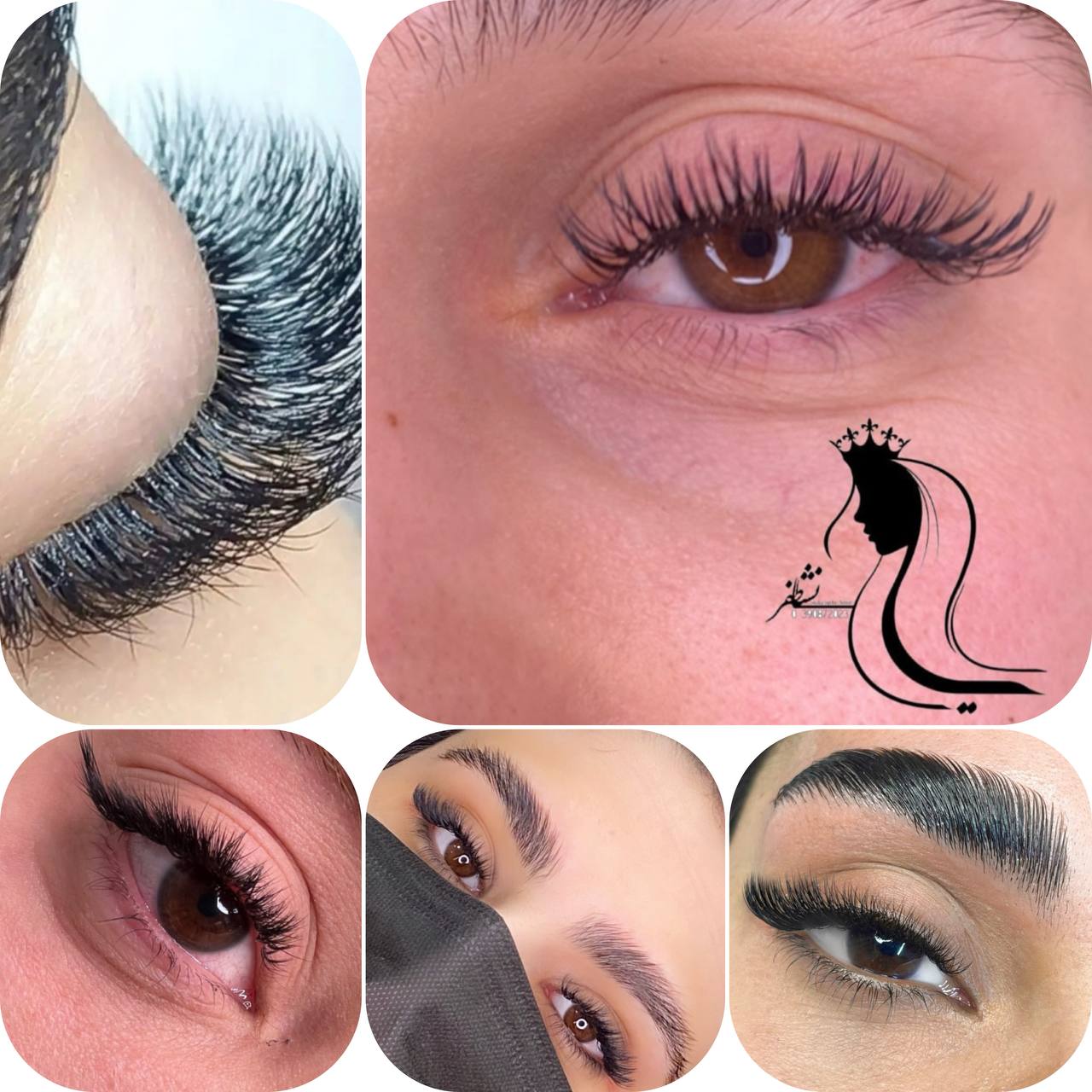 کاشت مژه در فردیس