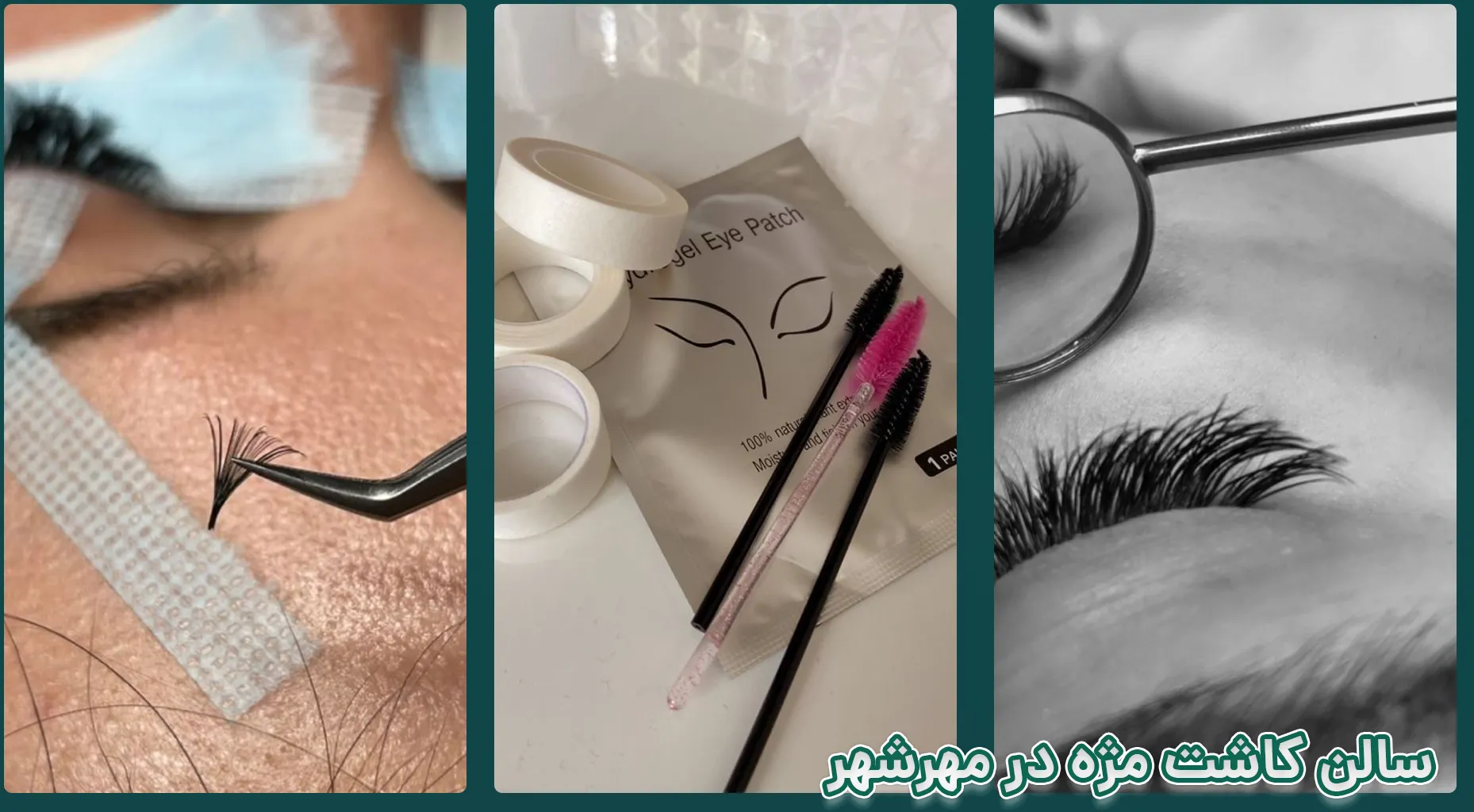 کاشت مژه مهرشهر