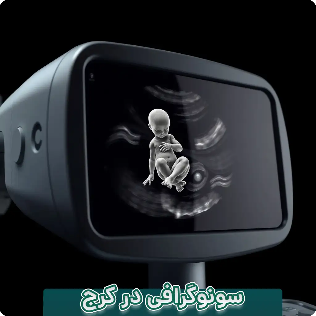 سونوگرافی در کرج