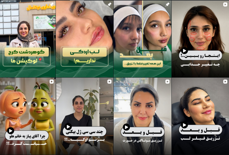 کلینیک تزریق فیلر بادی در کرج