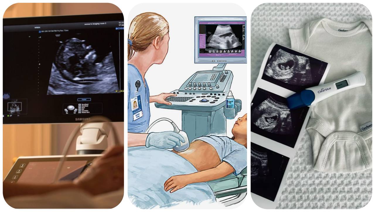 سونوگرافی در کرج