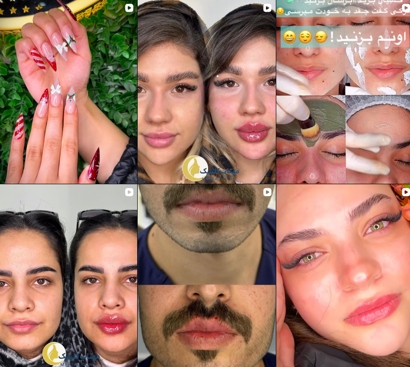 معرفی سالن کاشت مژه در گوهردشت