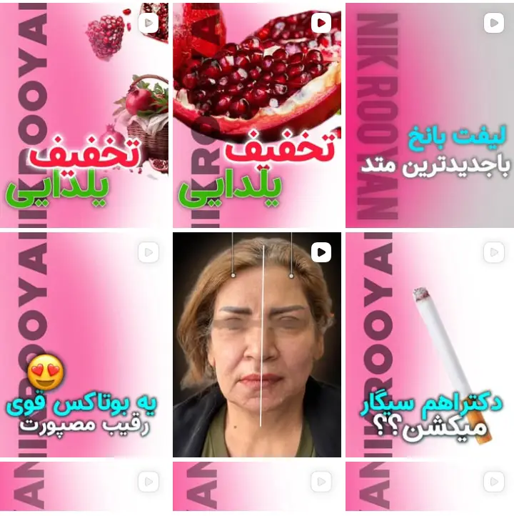 فیشیال مو در کرج