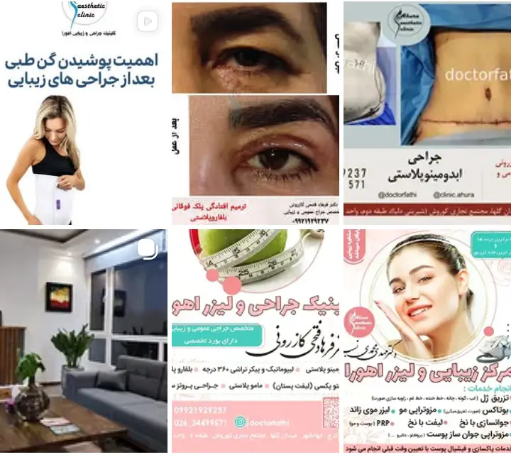 کلینیک لیزر موهای زائد باغستان