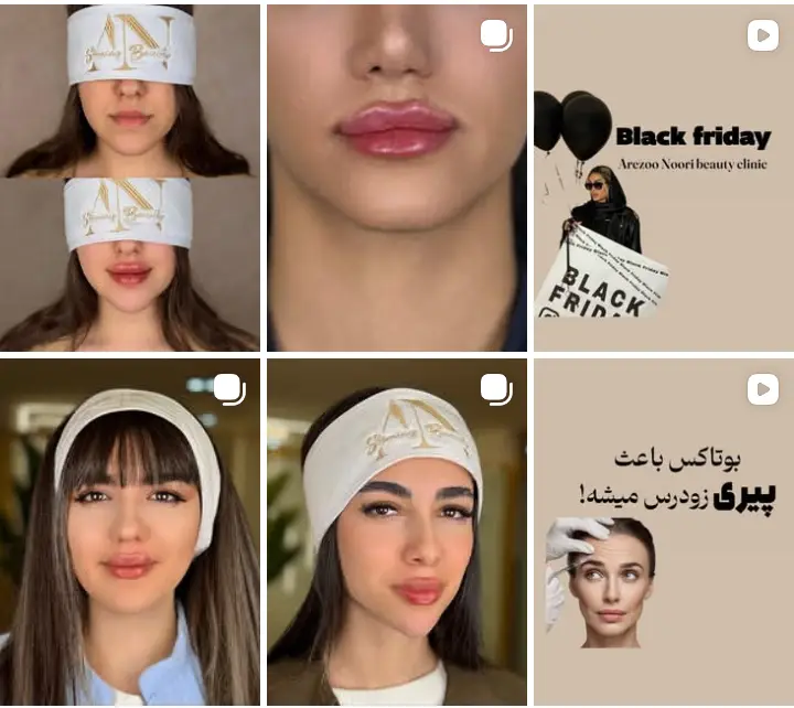 بهترین مرکز فیشیال در کرج