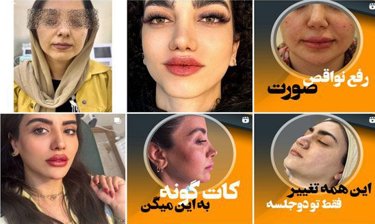 فیشیال پوست در گوهردشت
