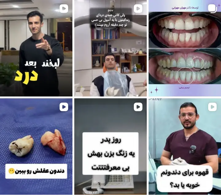 روکش دندان گوهردشت
