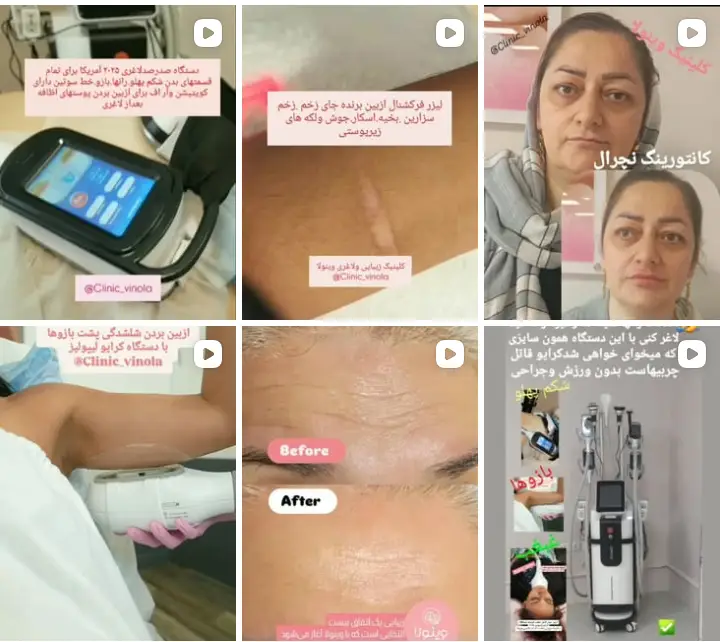 بهترین مرکز لاغری در کرج