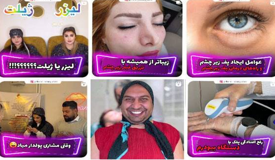 کلینیک تزریق ژل لب در کرج