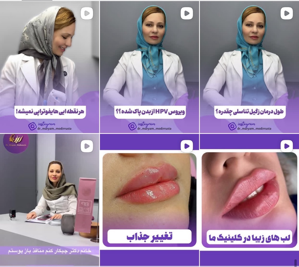 تزریق ژل لب در باغستان