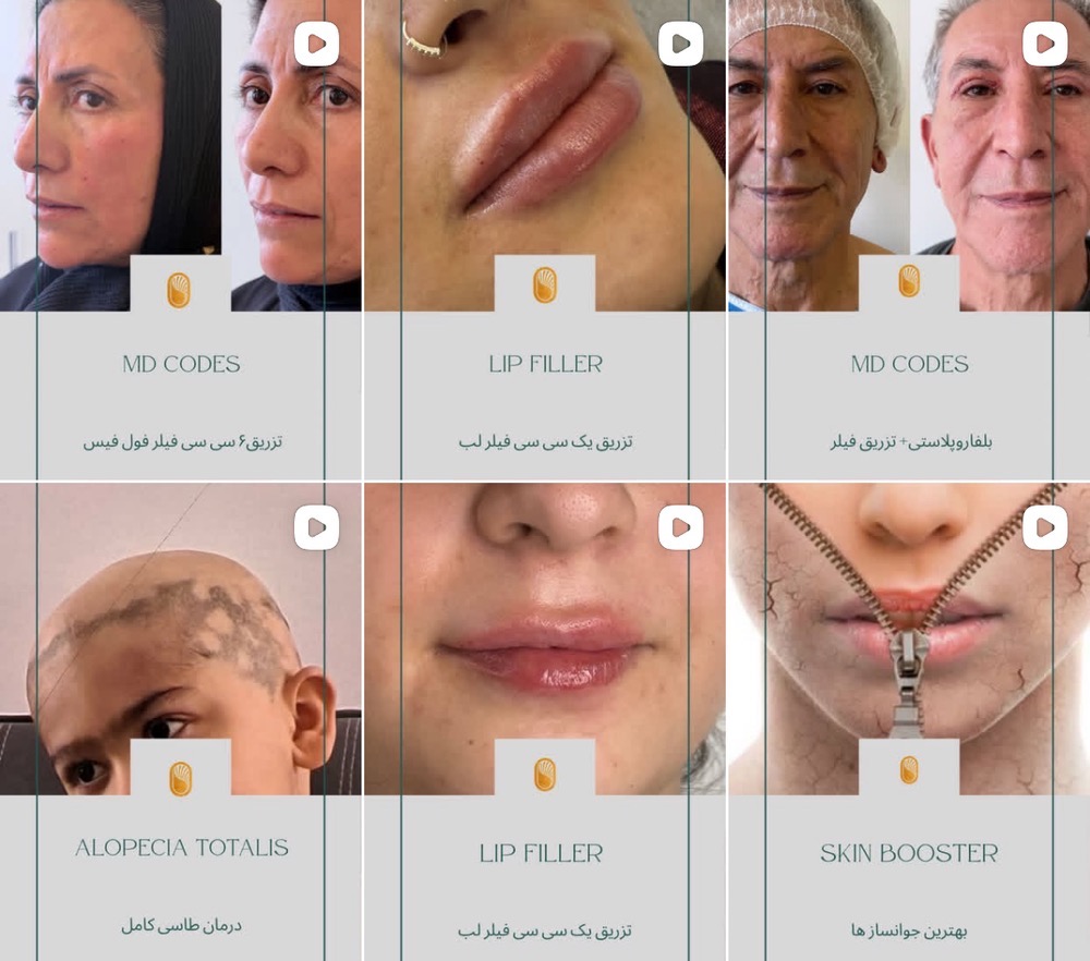 بهترین کلینیک جوانسازی پوست در کرج