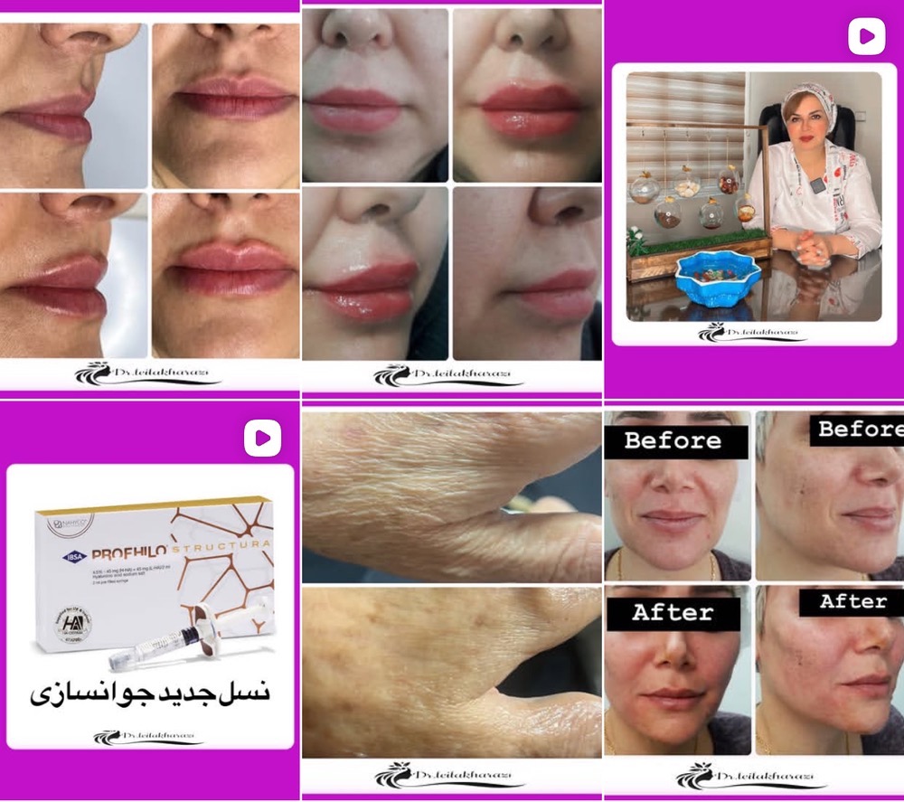 مرکز جوانسازی پوست در کرج