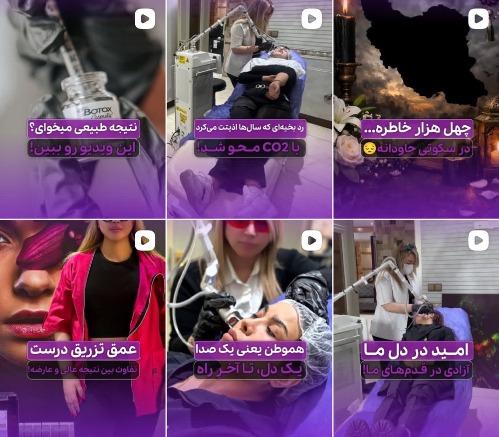 بهترین مرکز پاکسازی تاتو در کرج