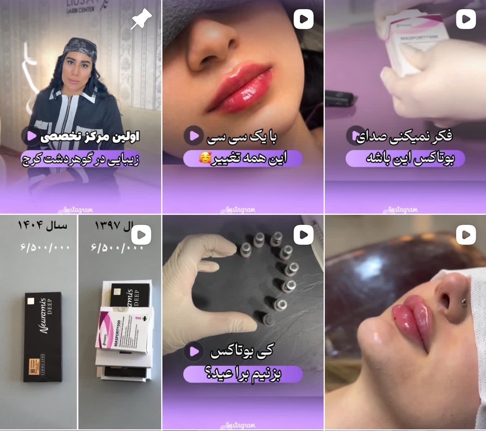 مرکز تزریق بوتاکس در کرج