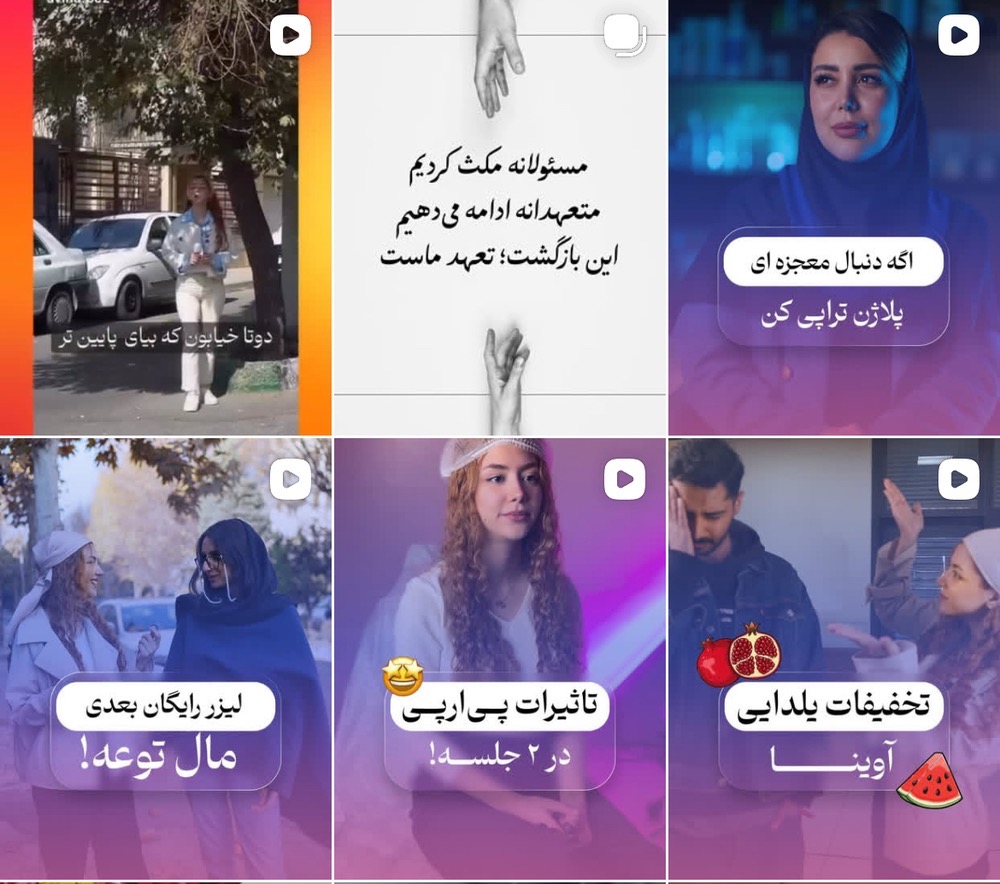 معرفی تزریق بوتاکس در کرج