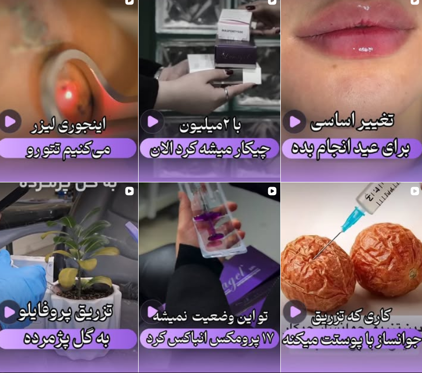 جوانسازی پوست در کرج